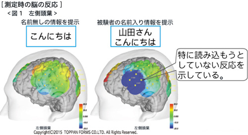 測定時の脳の反応　図1　左側頭葉
